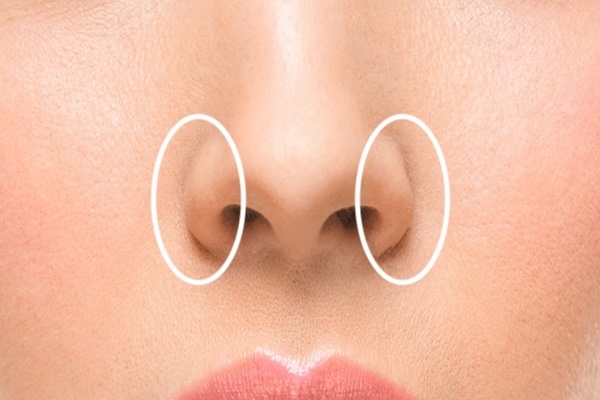 Botox/Диспорт/Xeomin/Релатокс Крылья носа «под ключ» - докоррекция бесплатно — Ботулинотерапия в Казани