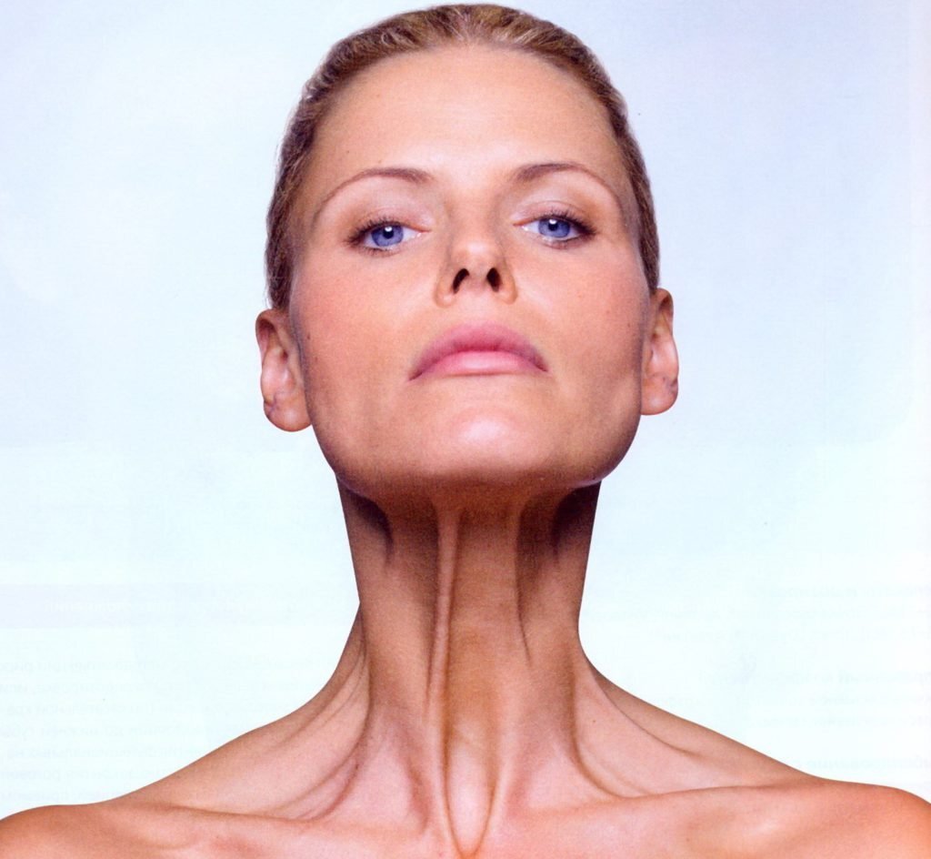 Botox/Диспорт/Xeomin/Релатокс Тяжи платизмы «под ключ» - докоррекция бесплатно — Ботулинотерапия в Казани