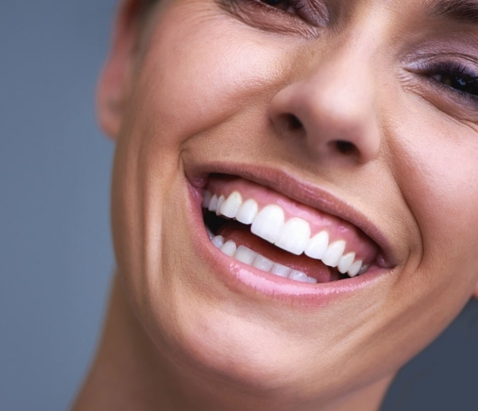 Botox/Диспорт/Xeomin/Релатокс Десневая или гингивальная улыбка «под ключ» - докоррекция бесплатно — Ботулинотерапия в Казани