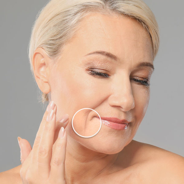 Botox/Диспорт/Xeomin/Релатокс Марионетки «под ключ» - докоррекция бесплатно — Ботулинотерапия в Казани
