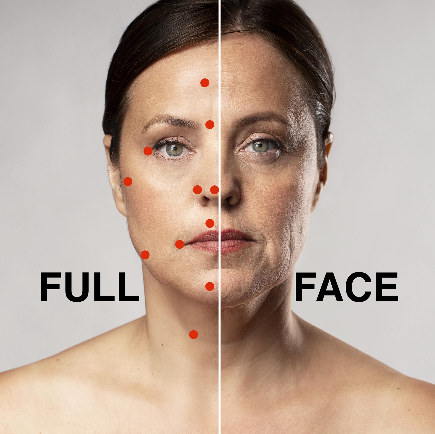Botox/Диспорт/Xeomin/Релатокс Full Face «под ключ» - докоррекция бесплатно — Ботулинотерапия в Казани